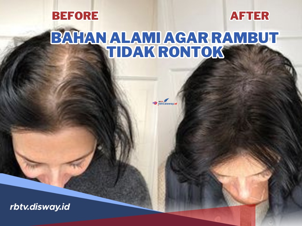 Rambut Rontok Parah? Tenang! Ini Bahan Alami agar Rambut Tidak Rontok, Rambut Auto Kuat dan Sehat 