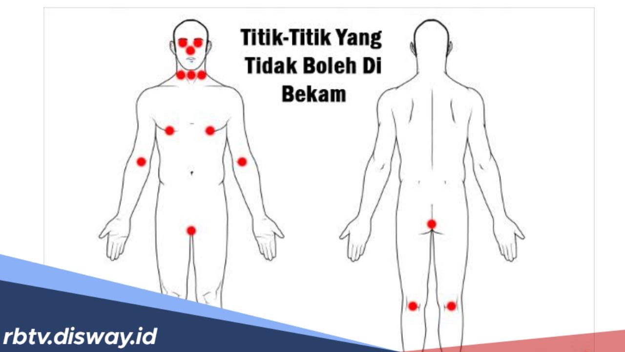 Jangan Sembarangan, Ini Titik Bekam yang Dilarang Serta Alasannya