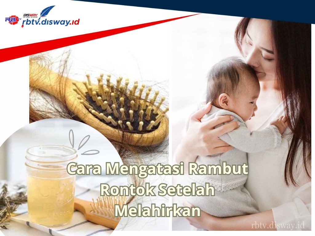 Jangan Cemas, Simak 5 Cara Mengatasi Rambut Rontok Setelah Melahirkan