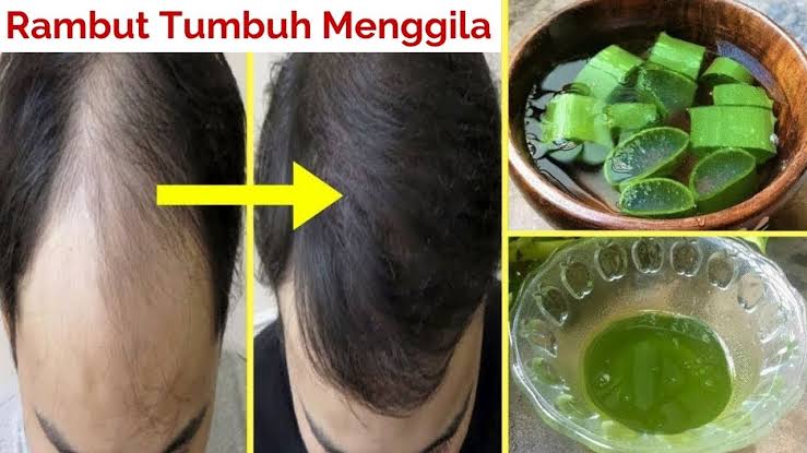 Gak Perlu Perawatan Mahal, Cukup Gunakan Lidah Buaya Atasi Rambut Rontok, Dijamin Rambut Lebat dan Kuat