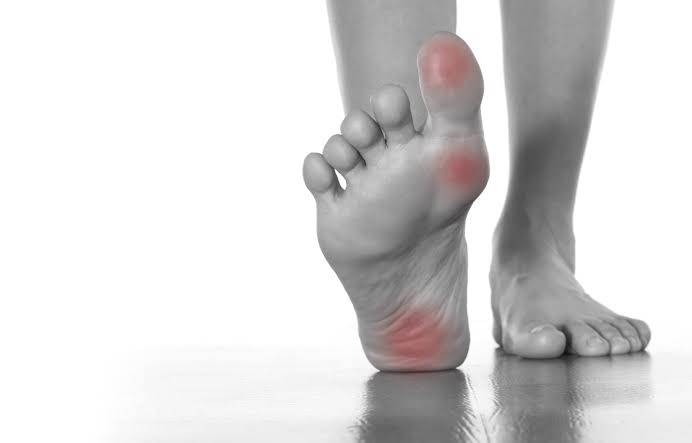 Sering Kesemutan di Kaki? Ini 11 Cara Atasi Kesemutan di Kaki yang Sering Kambuh