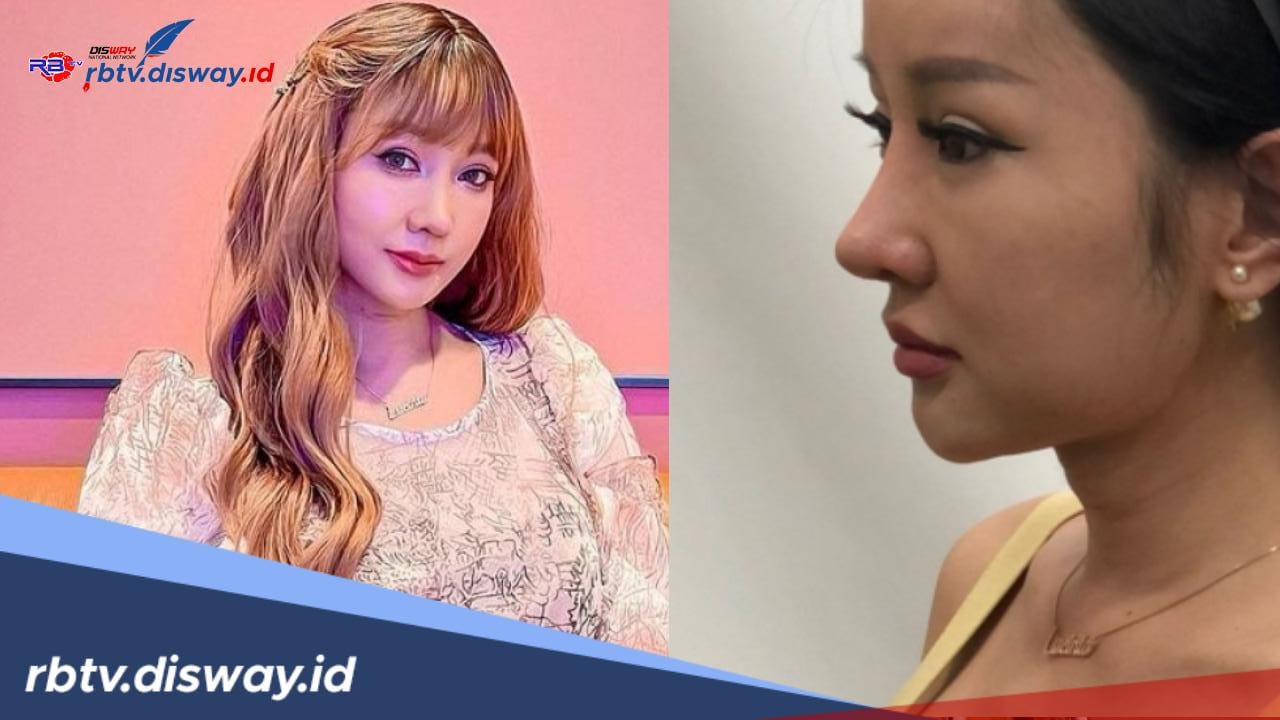 Meski Sempat Diejek, Lucinta Luna Mengaku Puas Hasil Oplas Hidung Terakhirnya