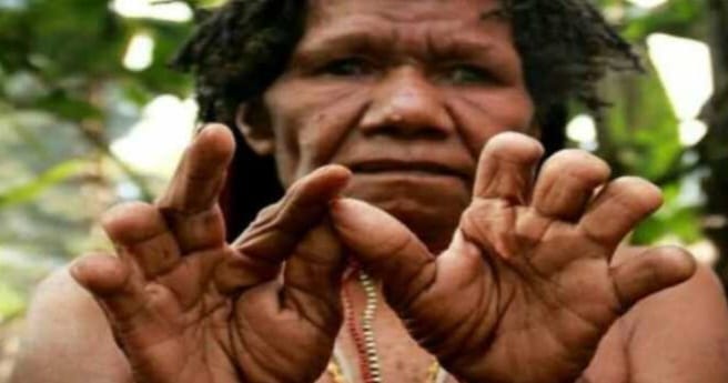Tradisi Potong Jari Suku Dani Papua, Wujud Kedukaan Ditinggal Anggota Keluarga 