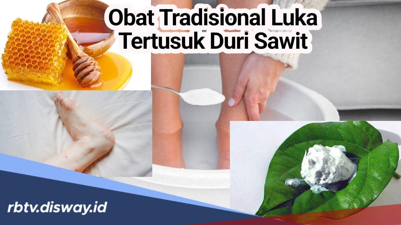  Ini Obat Tradisional untuk Luka Tertusuk Duri Sawit Selain Tindakan dan Obat Medis