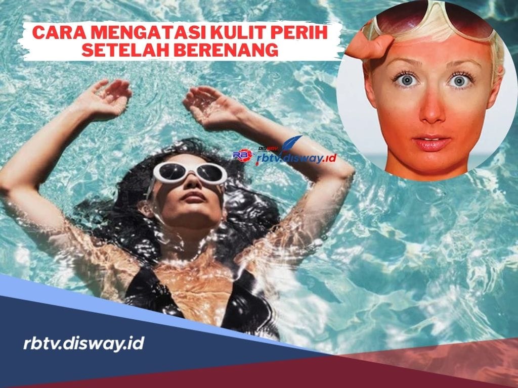 5 Cara Mudah Mengatasi Kulit Perih Setelah Berenang yang Bisa Anda Coba