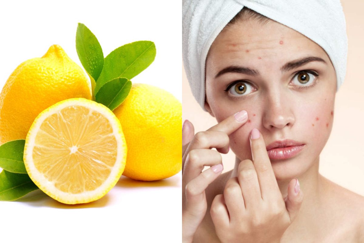 Rahasia Kulit Wajah Bebas Jerawat, Pakai Masker Lemon, Begini Caranya