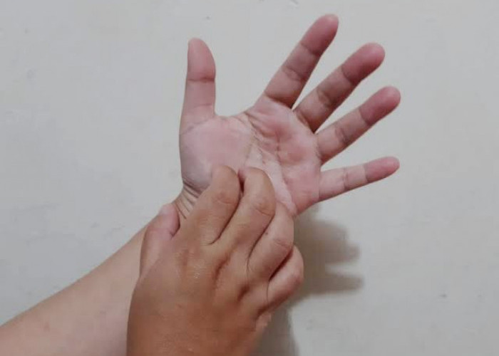 Telapak Tangan Gatal Benarkah Tanda Dapat Rezeki Besar? Ini Artinya dalam Primbon Jawa
