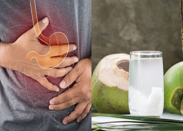 Memang Ada Manfaat Air Kelapa, Tapi jika Diminum Berlebihan Penderita Asam Lambung, Ini Akibatnya 