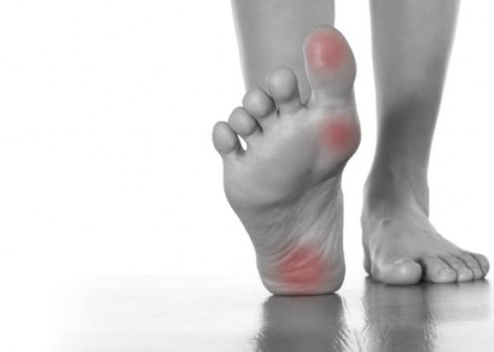 Sering Kesemutan di Kaki? Ini 11 Cara Atasi Kesemutan di Kaki yang Sering Kambuh