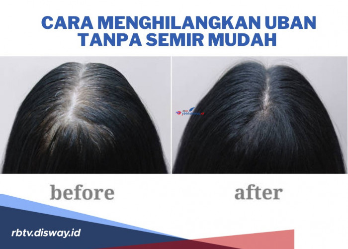 Cara Menghilangkan Uban Tanpa Semir dengan Bahan Ini, Hasil Sempurna jika Konsisten