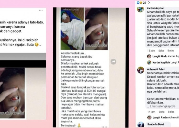 Siswa Pecah Mata  Akibat Lato-Lato Bukan di Benteng, Sudah PGRI dan Kades Lacak Setiap Penjuru