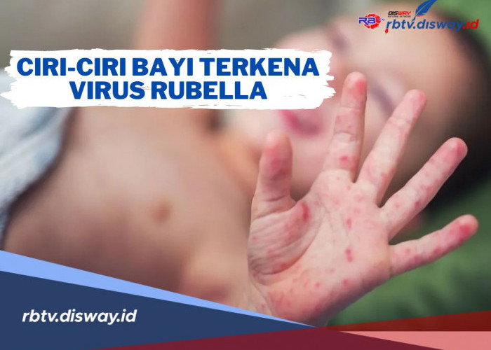 8 Ciri-ciri Bayi Terkena Virus Rubella, Salah Satunya Ruam dengan Bentuk Bintik-bintik Kemerahan